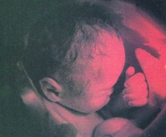 Foetus dans l'utérus lors du 8ème mois 