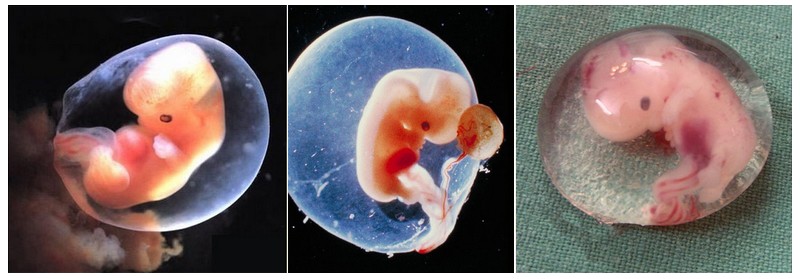 image de foetus a 6 semaines