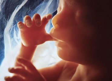 Foetus 20ème semaine de grossesse
