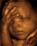 Foetus de 30 semaines 