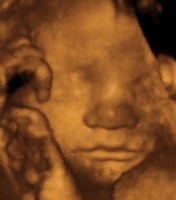 Foetus à 31 semaines de grossesse 