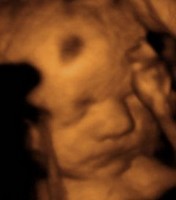 Le foetus à 8 mois de grossesse