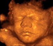 Foetus de 8 mois
