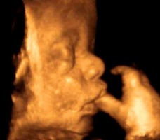 Echographie 3D du foetus de 9 mois
