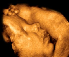 Echographie 3D du profil de bébé 
