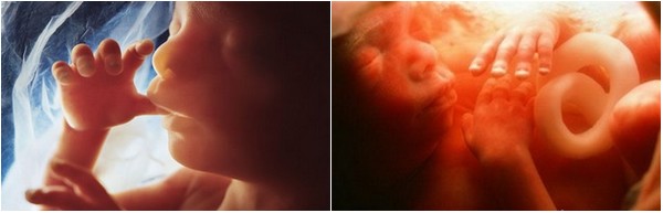 Foetus durant le 5ème mois de grossesse