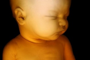 Image du foetus à 29 semaines de grossesse