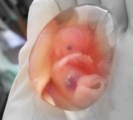 L’AVORTEMENT..!! oici une image d’un embryon de deux mois 