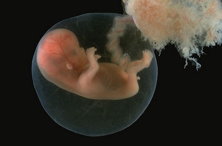 image de foetus de 9 semaine