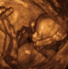 Développement foetus à 14 semaines de grossesse