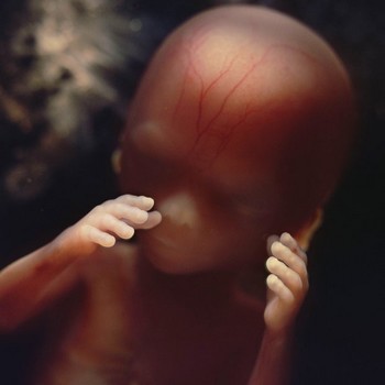 Foetus 16ème semaine de grossesse