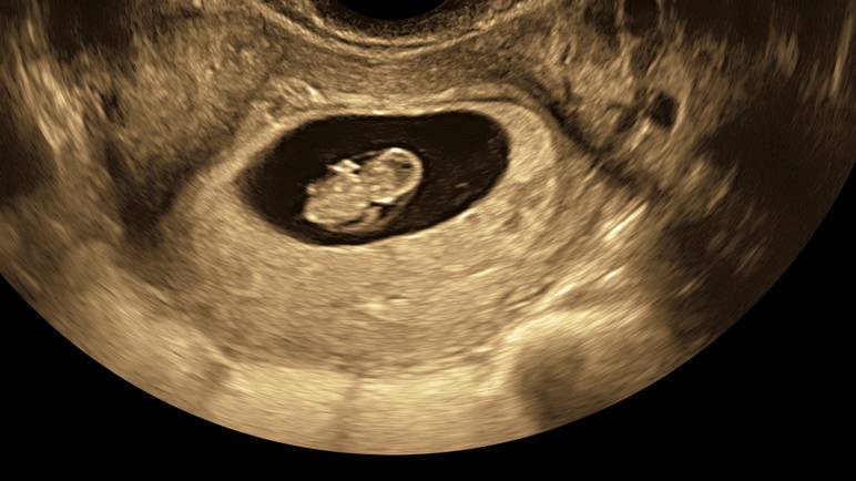 7 semaines de grossesse échographie