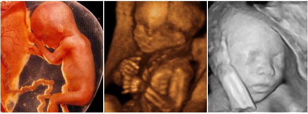 Grossesse semaine par semaine - Foetus 17 semaines
