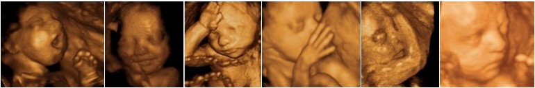 Grossesse semaine 23 : Développement du foetus