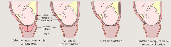Dilatation du col de l'utérus grâce aux contractions utérines