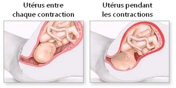 L'utérus et les contractions