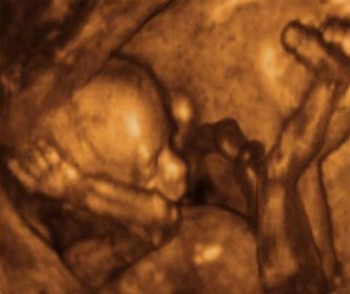 Echographie foetus 16ème semaine de grossesse 