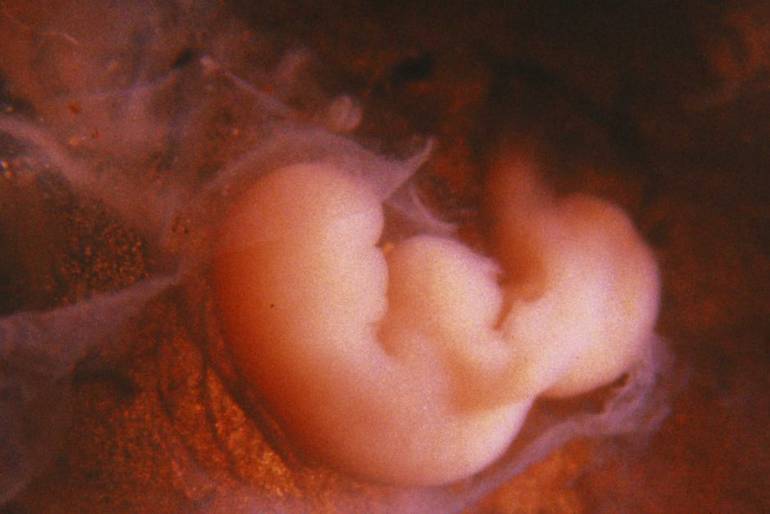 4 semaines de grossesse : embryon
