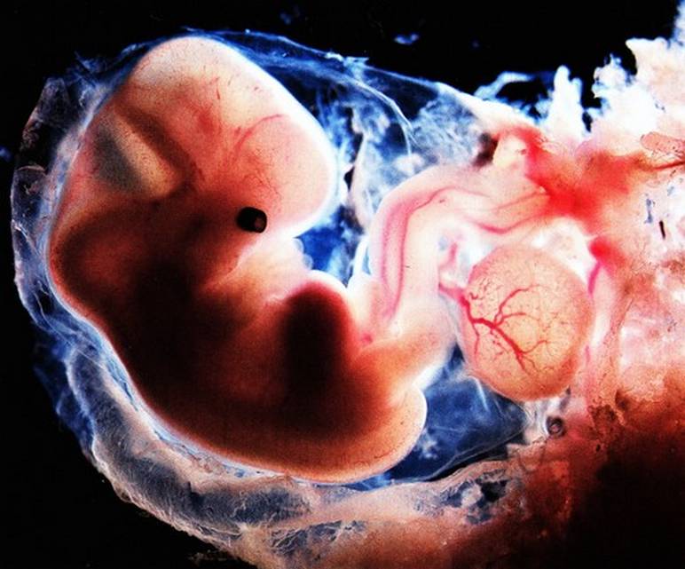 Embryon à 6 semaines de grossesse