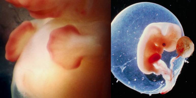 L'embryon à la 6ème semaine de grossesse