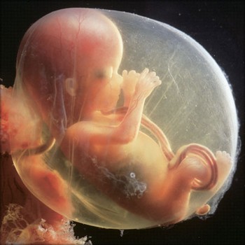 Foetus 15ème semaine de grossesse