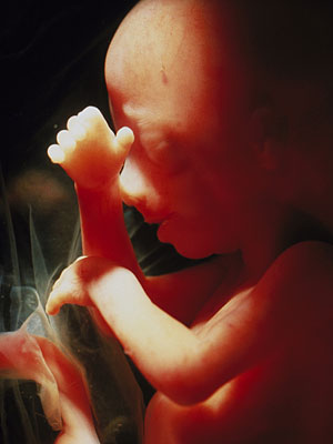 Image d'un foetus de 16 semaines