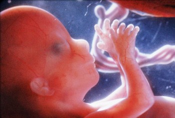 Foetus 17ème semaine de grossesse