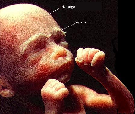 Foetus de 24 semaines dans le ventre de sa maman