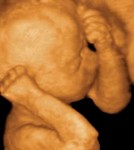 Echographie 3D d'un bébé de 6 mois