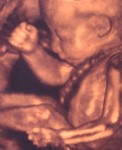 Echographie 3D du foetus de 7 mois