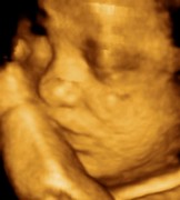 Foetus de 29 semaines en échographie 3D