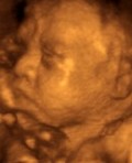 Echographie 3D d'un foetus de 7 mois