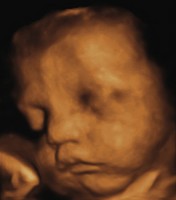 Visage du bébé à l'échographie 3D
