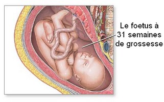Position du foetus en fin de grossesse : Genoux pliés, jambes et bras croisés, menton contre la poitrine.