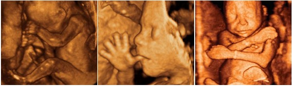 Développement du foetus - 5ème mois de grossesse