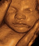 Le visage du foetus à 6 mois de grossesse