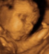 Echographie 3D d'un foetus de 7 mois 