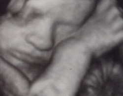 Echographie 3D du foetus de 8 mois