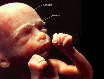 Foetus de 6 mois